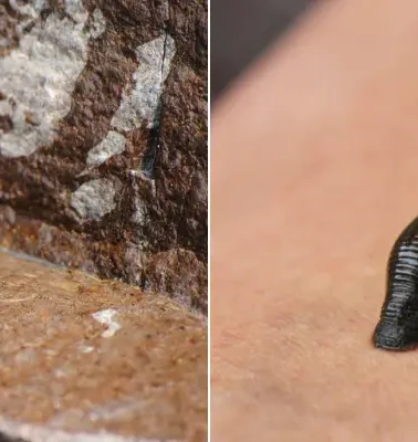 How to Deal With Leeches on Trek in Nepal?