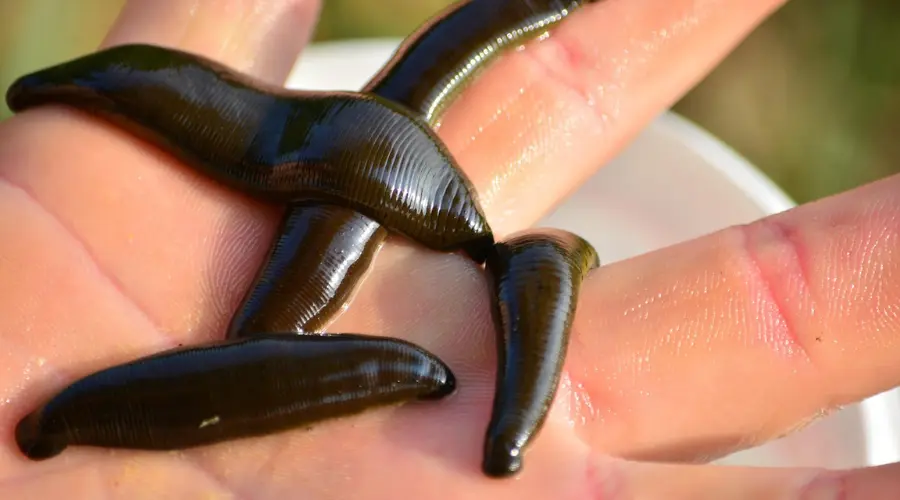 Leeches on the hand